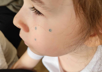 Dzień Piegów z przedszkolakami